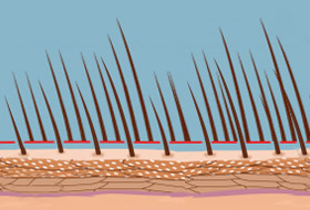 Quantum sistem saçınız uzar